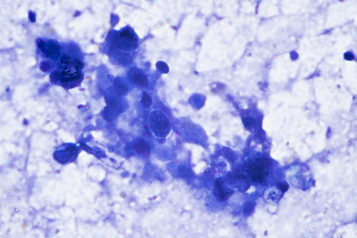 Hémocytes (cell. phagocytaires) : huître, frottis, G